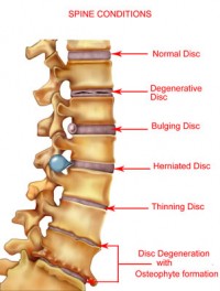 spineconditions