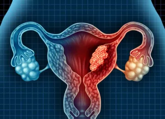 Ali ima odstranitev maternice in jajčnikov vpliv na demenco? Uterus cancer and endometrial malignant tumor as a uterine medical concept as dangerous growing cells in a female body attacking the reproductive system as a symbol of cervical disease treatment diagnosis and symptoms with 3D illustration elements.