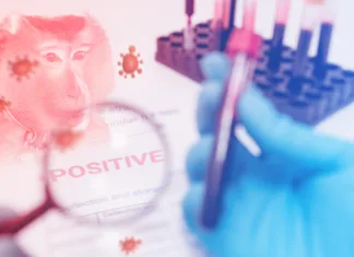 Vas mora biti strah opičjih koz? A magnifying glass that zooms in on information about monkeypox test positive results in a lab.