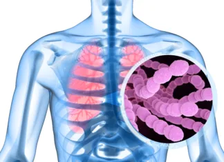 Pnevmokokne okužbe: Ne čakajte na zimo, zaščitite se že danes! Streptococcus pneumoniae, or pneumococcus, is Gram-positive coccus shaped pathogenic bacteria which causes many types of pneumococcal infections in addition to pneumonia. 3D illustration