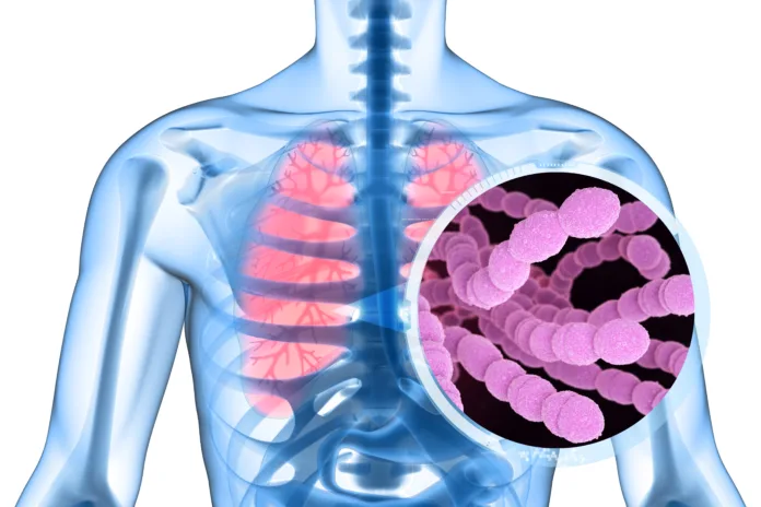 Streptococcus pneumoniae, or pneumococcus, is Gram-positive coccus shaped pathogenic bacteria which causes many types of pneumococcal infections in addition to pneumonia. 3D illustration