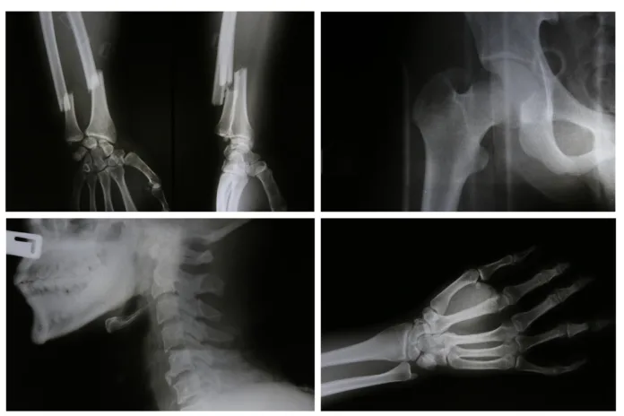 collection of x-ray photo