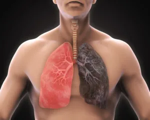 Healthy Lung and Smokers Lung Illustration. 3D render