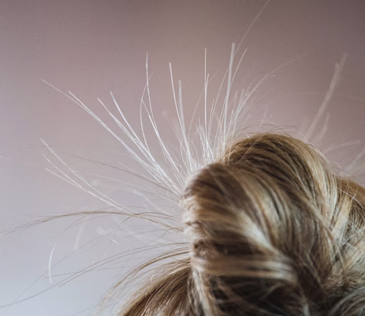 Statična elektrika: mala zimska nadloga, ki nas spravlja ob živce