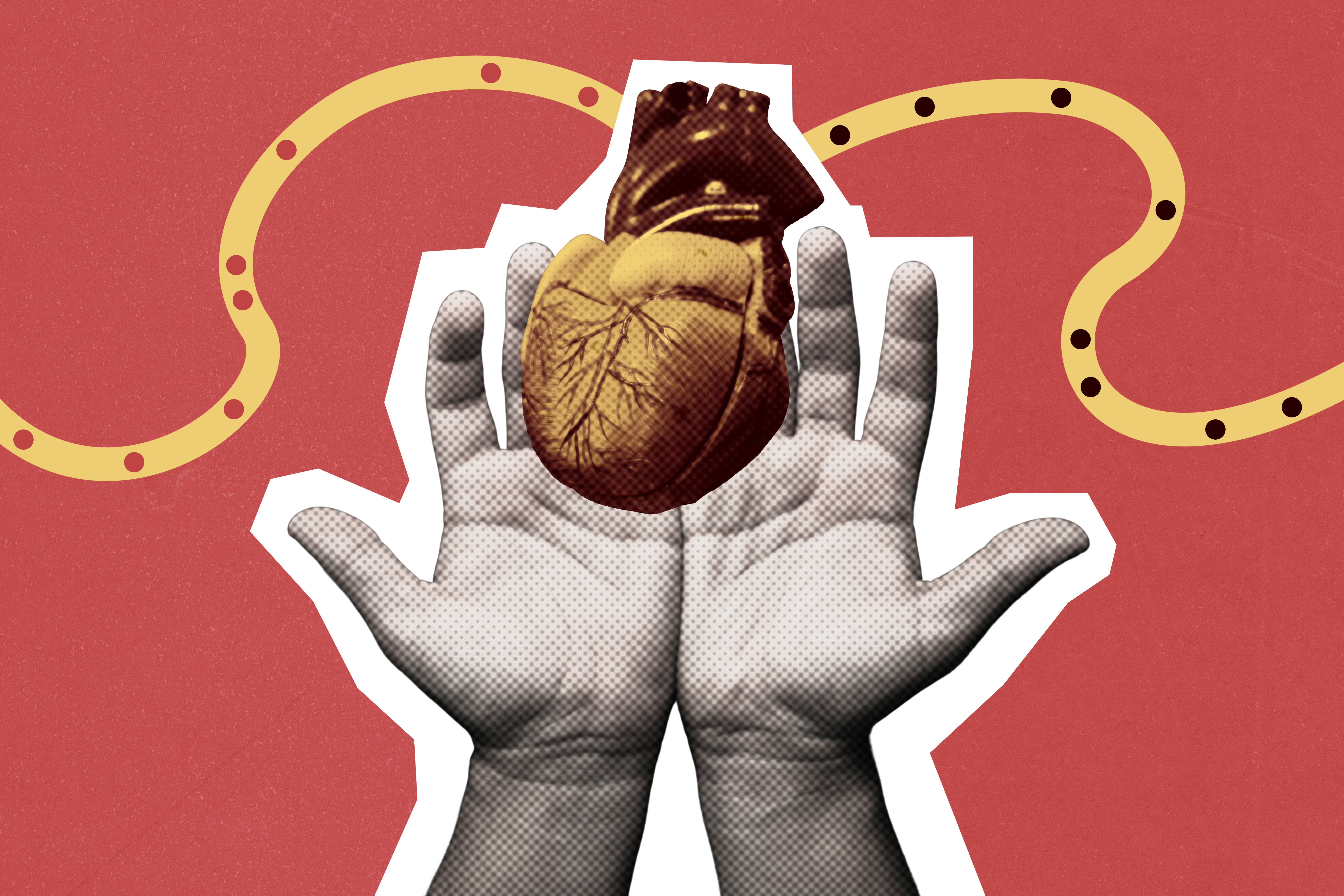 hand-giving-heart-transplant-and-organ-donation-concept-blood-flowing-through-arteries-retro-pop-art-medical-collage-illustration-stockpack-istock organ donor donation heart transplant