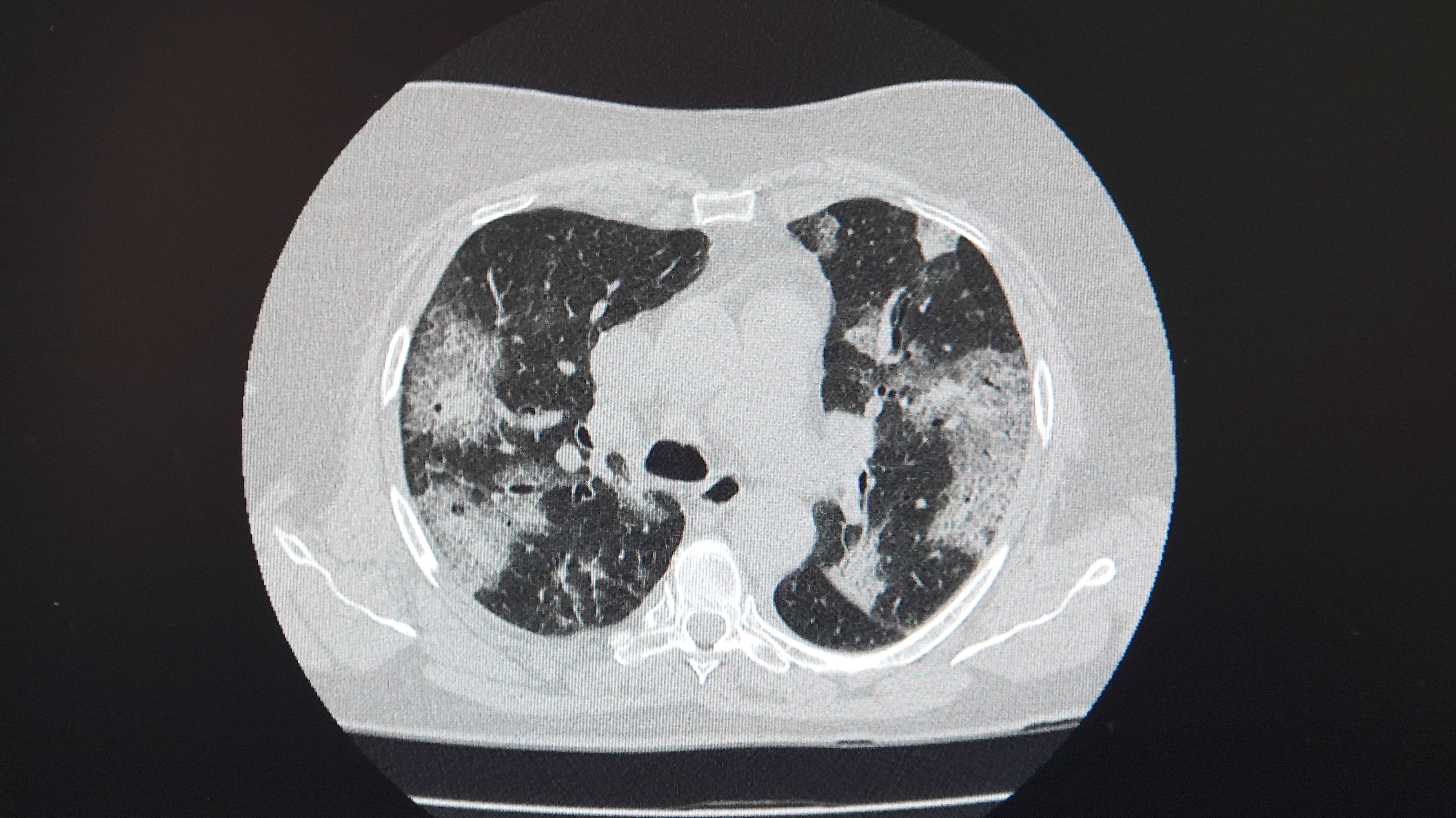 Computed tomography (CT) is a modern and high-tech examination method. Widely used in medicine all over the world. Allows you to identify various serious diseases in the human body.