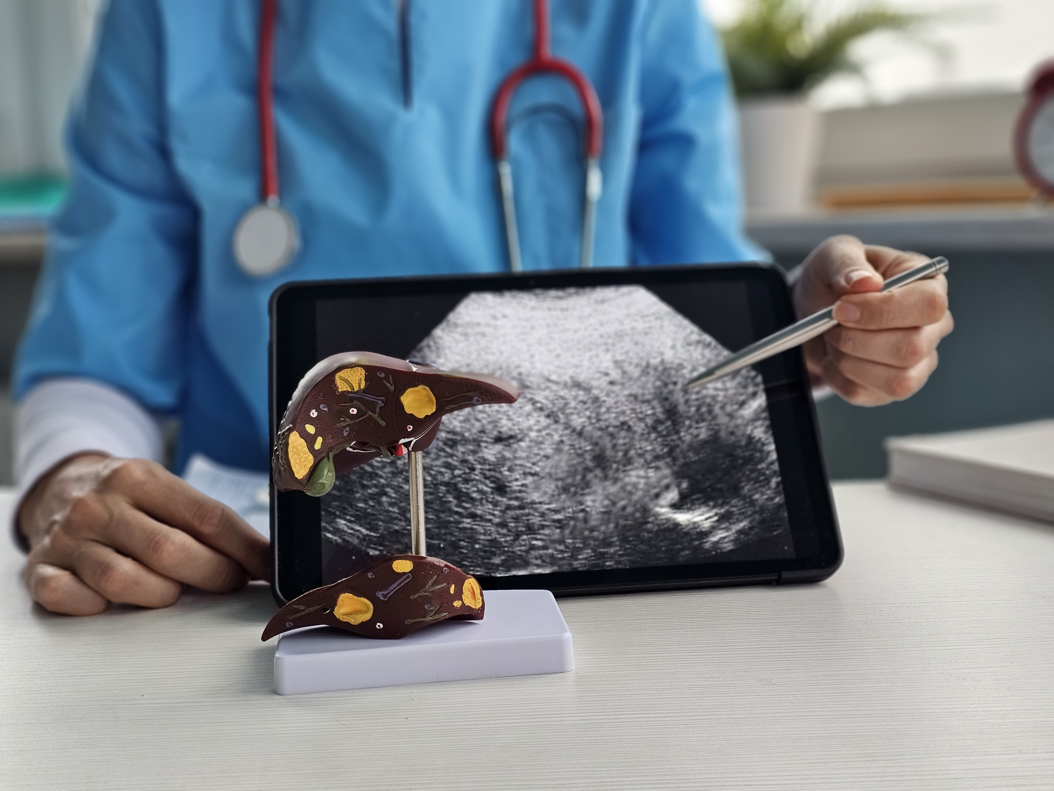 Medical professional examines liver model alongside ultrasound on tablet during patient consultation in a clinic